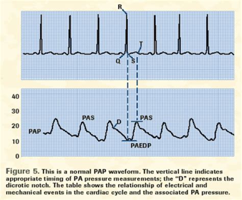 Hemodynamic Monitoring Part Flashcards Quizlet