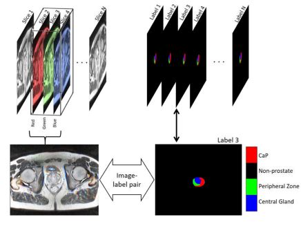 A Deep Learning Based Approach For The Detection And Localization Of