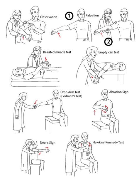 Diagnosing Supraspinatus Tears Supraspinatus Muscle Rotator Cuff