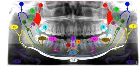 Juegos De Ciencias Juego De Mand Bula Cerebriti