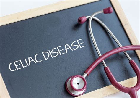 Everything You Need To Know About Celiac Disease Alborz Medical Tourism