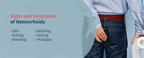 Common Hemorrhoid Signs And Symptoms Hemorrhoid Answers