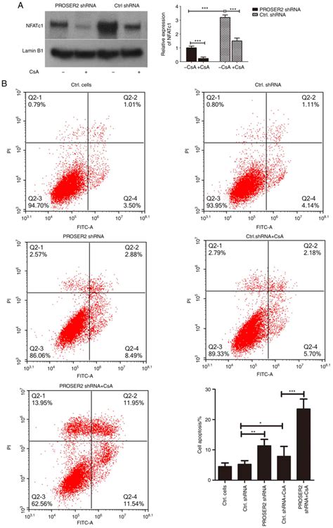 PROSER2 Is A Poor Prognostic Biomarker For Patients With Osteosarcoma