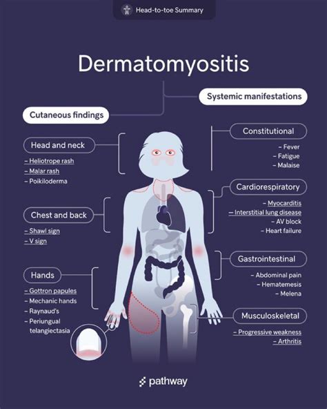 Poikiloderma Dermatomyositis