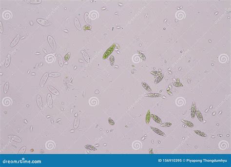 Euglena Is A Genus Of Single Celled Flagellate Eukaryotes Under