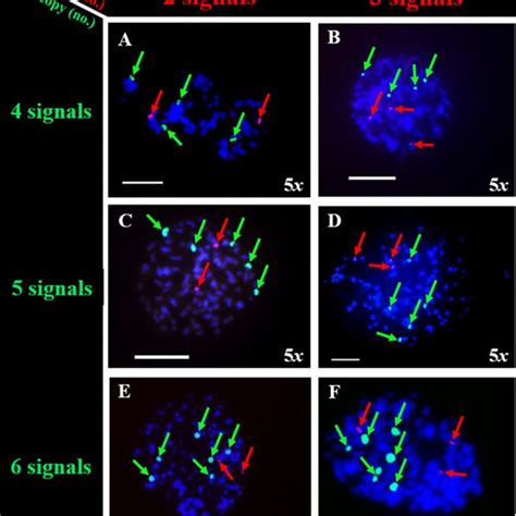 Fluorescent In Situ Hybridization Fish Analysis Of Metaphase Root