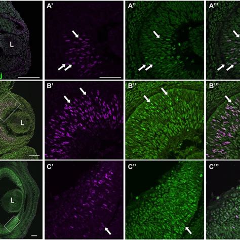 Colocalization Of Rbpj And Atoh Proteins During Retinal Neurogenesis