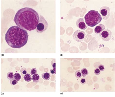 Erythropoiesis And General Aspects Of Anaemia Flashcards Quizlet