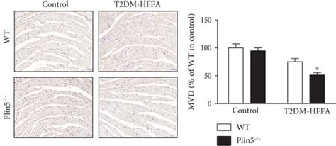 The Influence Of Plin Deficiency On Cmec Injury Induced By Hg Hffas