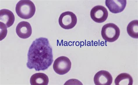 Lecture 19 Lab Evaluation Of Hemostasis I Flashcards Quizlet