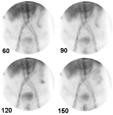 Simm Gastroenterolog A