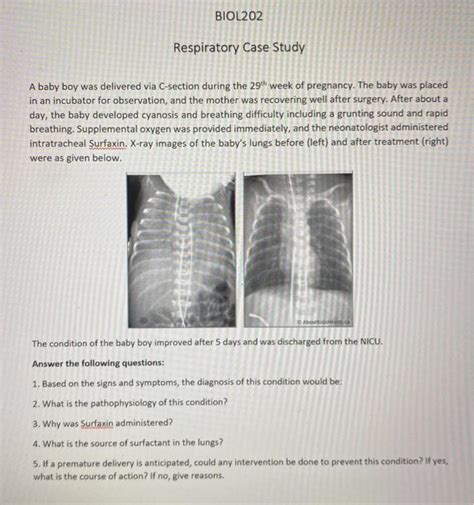 Solved Biol Respiratory Case Study A Baby Boy Was Chegg