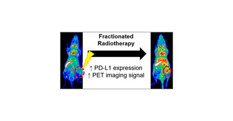 Noninvasive Imaging And Quantification Of Radiotherapy Induced Pd L