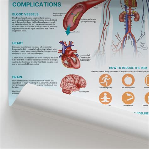 anatomy  hypertension poster blood pressure education