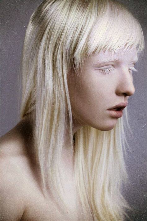 Albino Model Beauty Albinism