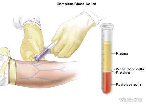 Chronic Lymphocytic Leukemia Treatment - NCI