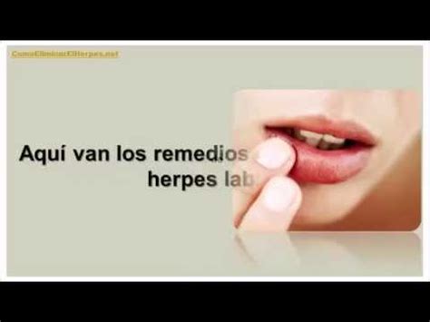 Como Eliminar El Herpes Labial Formas De Como Eliminar El Fuego