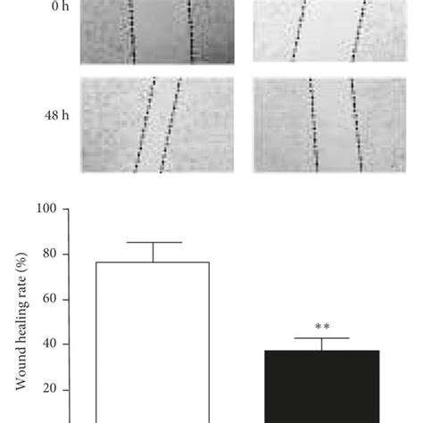 Snhg7 Knockdown Repressed Malignant Behavior Of Hs746 T Cells A