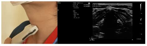 Point Of Care Ultrasound A Review Of Ultrasound Parameters For