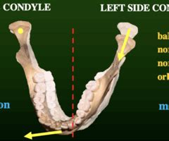 L13 Determinants Of Occlusal Morphology 2 HORIZONTAL Factors