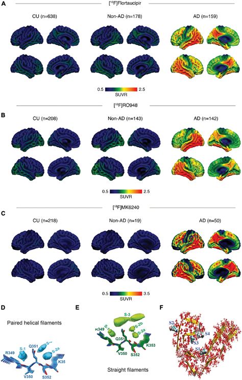 Frontiers Recent Developments In Positron Emission Tomography Tracers