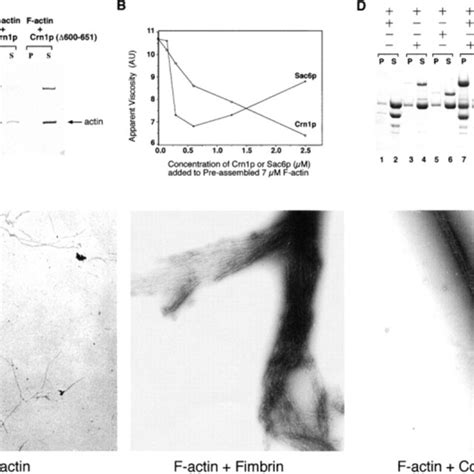 Crn P Binds To Actin Filaments And Microtubules A Immunoblot Of