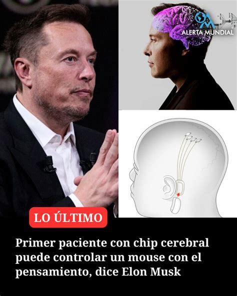 El Primer Paciente Humano Al Que Se Le Implantó Un Chip Cerebral De Neuralink Deredestv