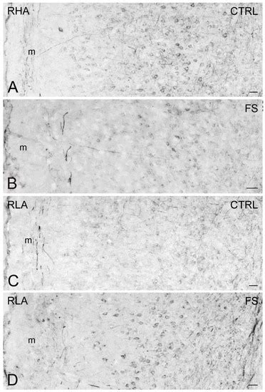 Ijms Free Full Text Acute Stress Induces Different Changes On The