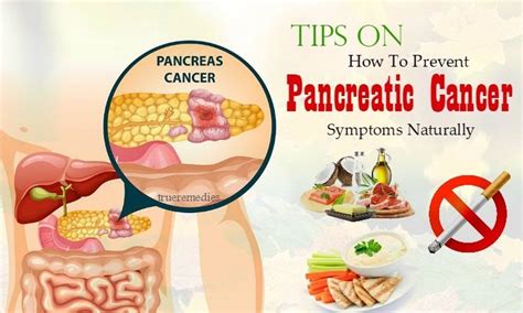 Tips On How To Prevent Pancreatic Cancer Symptoms