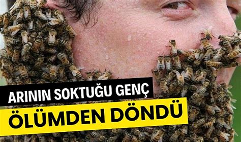 Arı sokması sonrası nefesi kesilen genç ölümden döndü GENEL Gazete