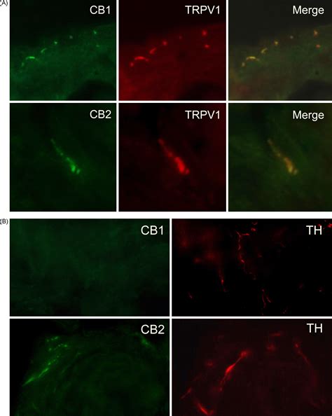 Localization And Function Of Cannabinoid Receptors In The Corpus