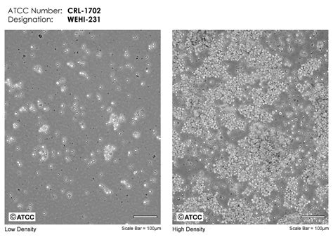 WEHI 231细胞ATCC CRL 1702细胞 WEHI231小鼠B淋巴细胞株购买价格培养基培养条件细胞图片特征等基本信息 生物风