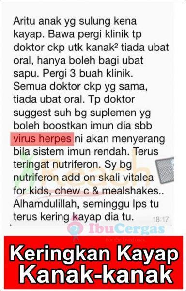 Testimonial Ubat Kayap Secara Semulajadi Tradisional Ubat Kayap Shaklee