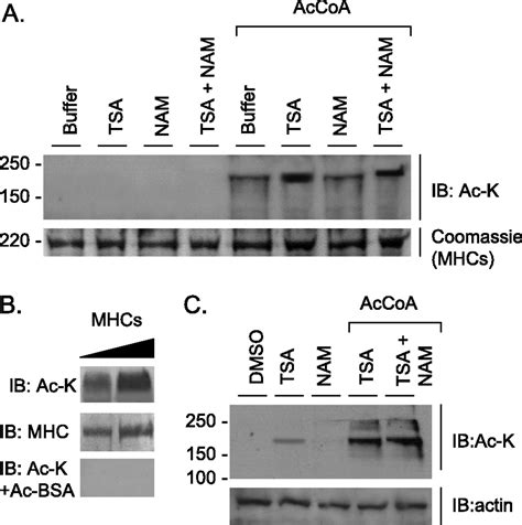 Hdac Dependent Reversible Lysine Acetylation Of Cardiac Myosin Heavy