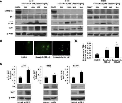 Microrna 106a Targets Autophagy And Enhances Sensitivity Of Lung Cancer