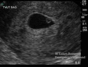 Fetal Measurements