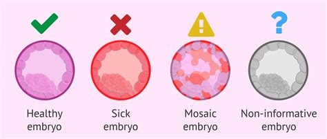 Possible Pgd Results When Analyzing Embryos