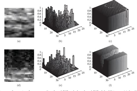 Figure 3 From Phase And GVF Based Level Set Segmentation Of Ultrasonic