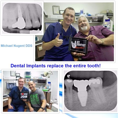 Dental Implant Dentist For Friendswood Teeth Implants