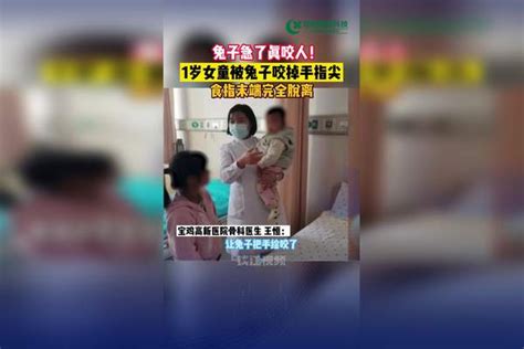 兔子急了真咬人！陕西宝鸡1岁女童被兔子咬掉手指尖 宝鸡 兔子 女童