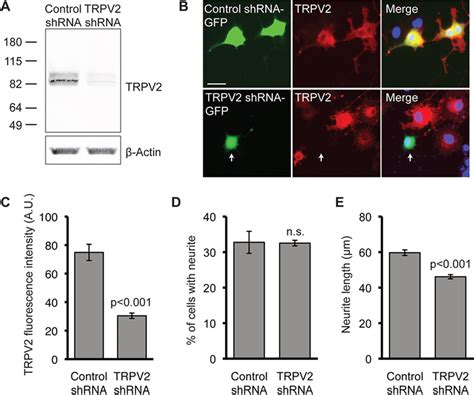 Silencing Of Trpv2 Expression Impairs Ngf Induced Neurite Outgrowth