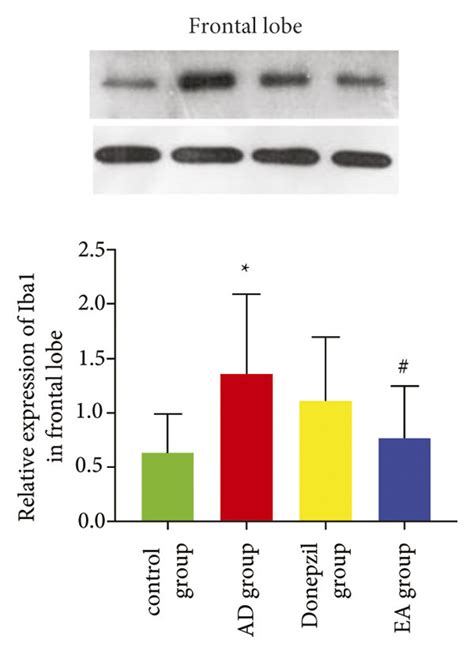 Results Of Western Blotting Test Iba Was Expressed Differently By