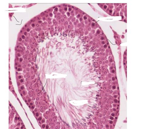 spermatogenesis histology Diagram | Quizlet