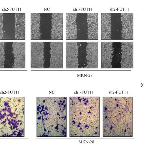 Knockdown Of Fut Inhibited The Gc Cells Mobility A Wound Healing