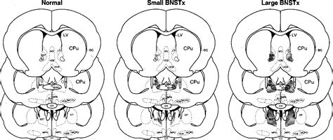 Figure 3 From The Effects Of Lesions Of The Bed Nucleus Of The Stria