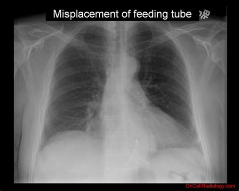 On Call Radiology Common Radiology Findings On Call And In The