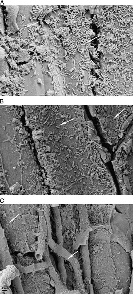 Sem Micrographs Showing Microorganisms Colonization In Roots Surface Of