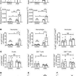 Increased Inflammatory Gene Expression And Cell Infiltration In The