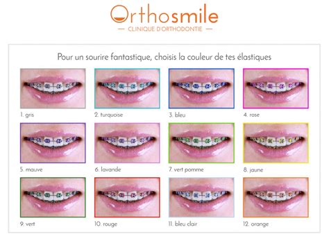 Bague Orthodontique Couleur Bague Femme Fine