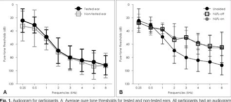 Figure 1 From The Influence Of Non Linear Frequency Compression On The Perception Of Speech And